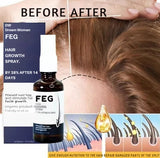 Dream Woman - Hair Growth Spray (Original) 50ml